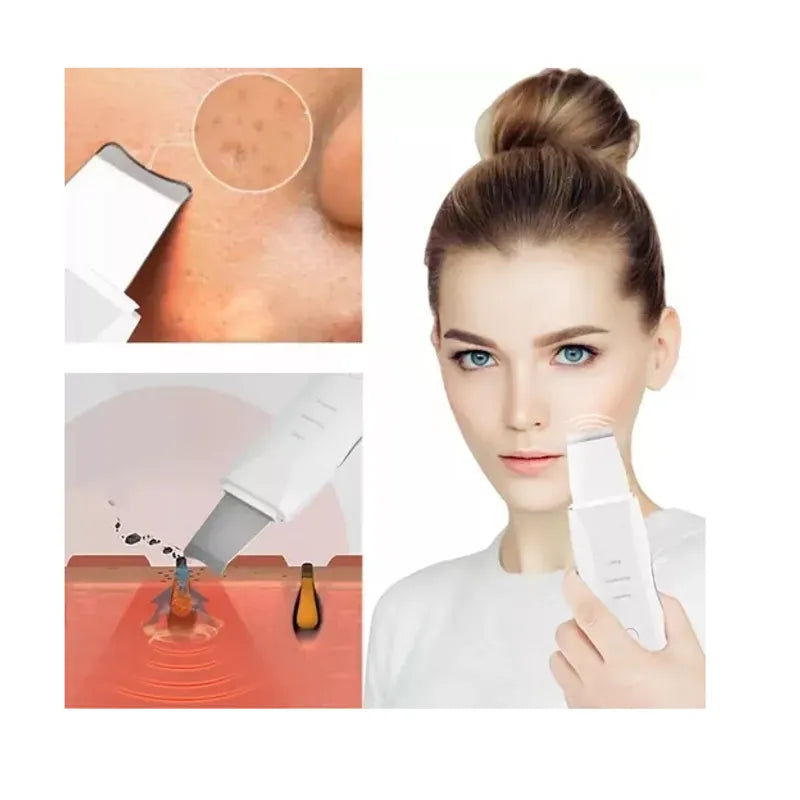 ESPATULA FACIAL ULTRASONICA🌟DELIVERY GRATIS🌟